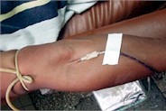 Donaci&oacute;n de sangre